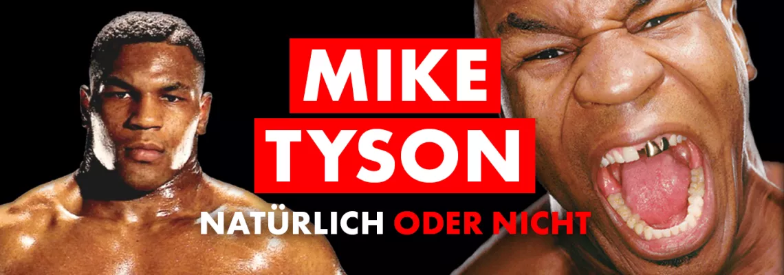 Mike Tyson: Natty oder nicht